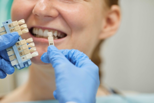 implante dental en boca de mujer