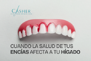 Periodoncia, boca con sangre en encías