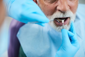 adulto mayor en dentista