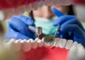 implante dental