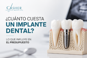 implante dental alicante precios