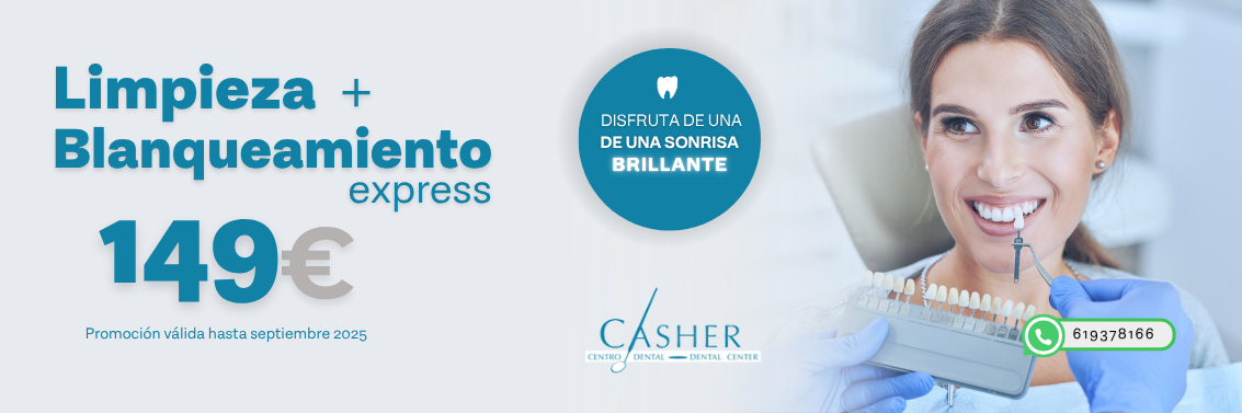 blanqueamiento dental alicante Blanqueamiento Dental Alicante