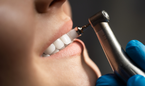 limpieza dental profunda