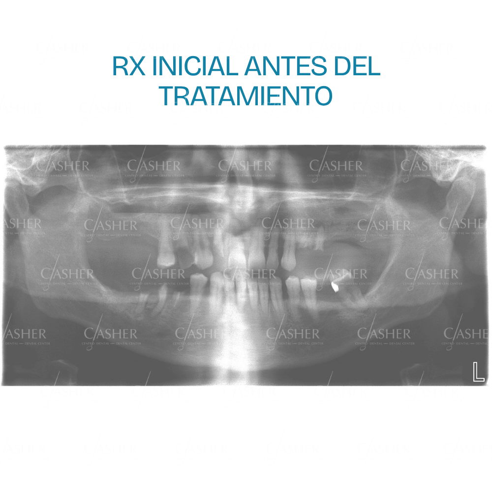 Situación dental del paciente antes del tratamiento