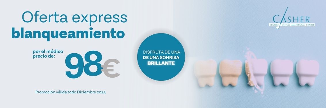 Blanqueamiento Dental Alicante
