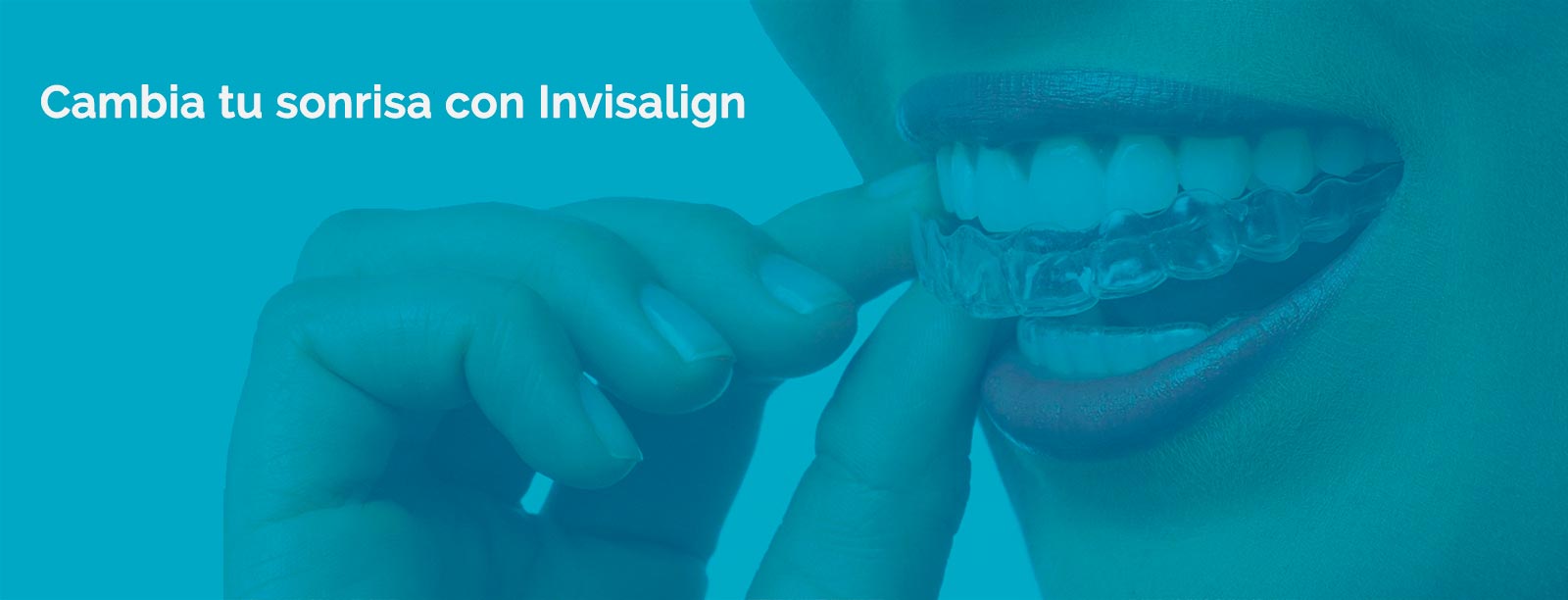 Sonrisa con Invisalign en Alicante