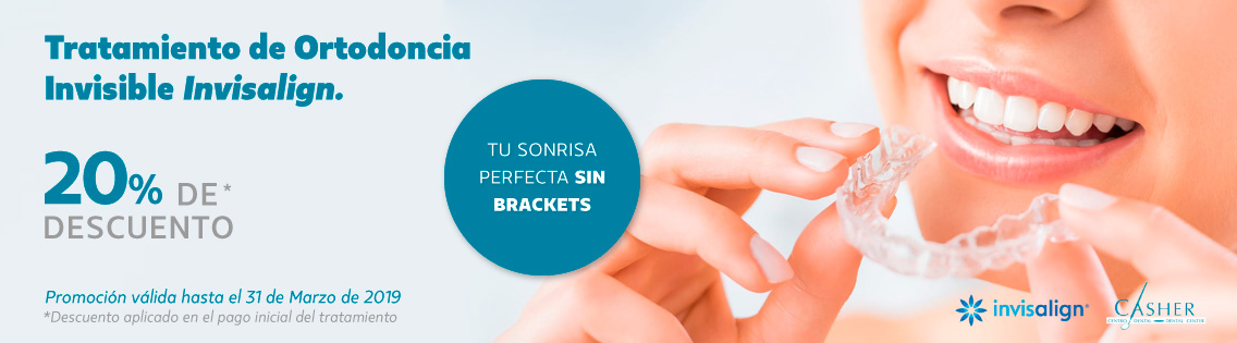 invisalign alicante Sonrisa con Invisalign en Alicante