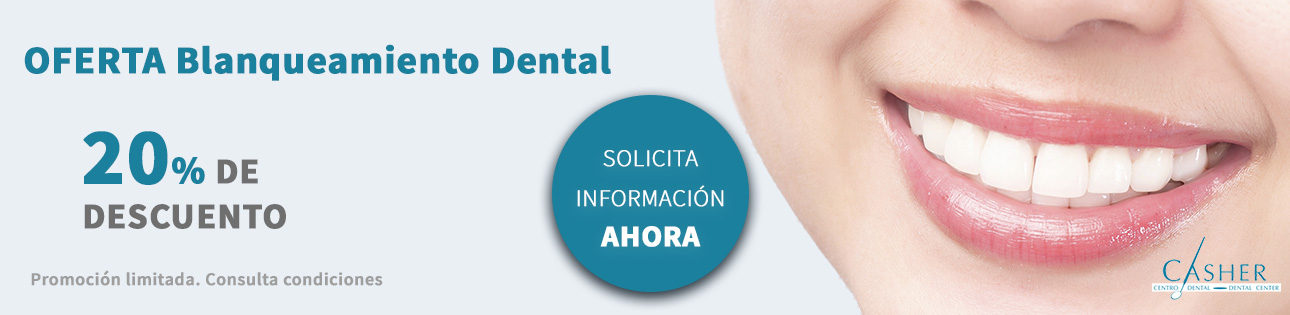 blanqueamiento dental alicante Blanqueamiento Dental Alicante