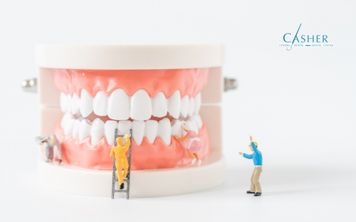 limpieza dental casher